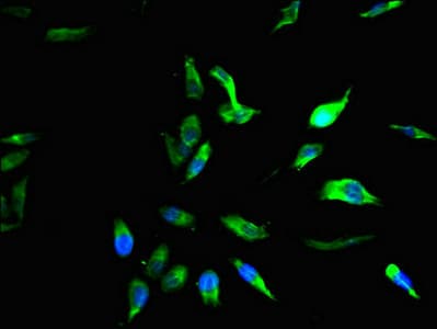 Polyclonal Rabbit anti-Human FAM102B Antibody