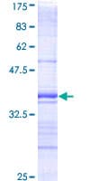 Human DAPK1 / DAP Kinase Protein (Recombinant GST, N-terminus)