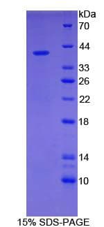 Mouse GFAP Protein (Recombinant His-T7)