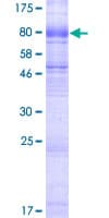 Human SLC6A19 Protein (Recombinant GST)