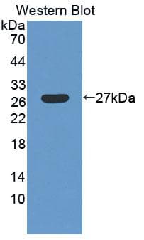 LRP1B Antibody