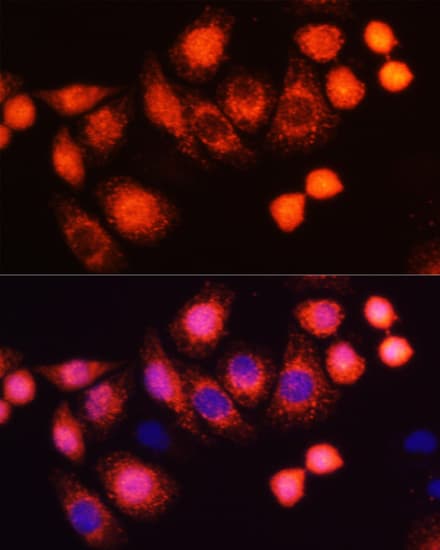 HRAS / H-Ras Antibody
