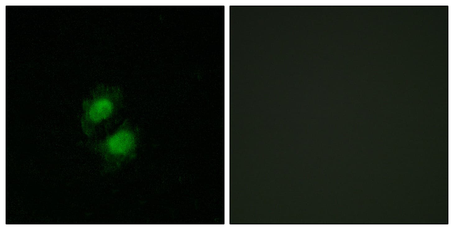 ZKSCAN5 Antibody (aa291-340)