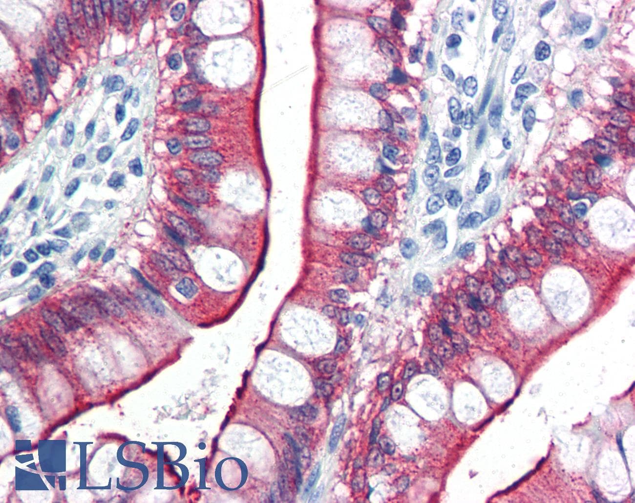 IHC-plus™ VIL1 / Villin Antibody