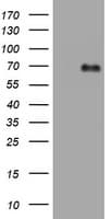 Monoclonal Mouse anti-Human NUMB Antibody (clone OTI2E8, aa1-365, IHC, WB)