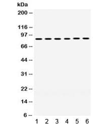 Polyclonal Rabbit anti-Human LOXL2 Antibody (WB)