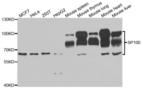 Polyclonal Rabbit anti-Human SP100 Antibody (IHC, WB)