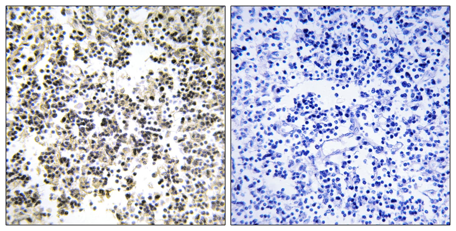 IGLL1 / CD179b Antibody (aa161-210)