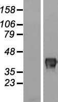 FAM83A Protein (Over-Expression Lysate Myc-DDK (Flag))
