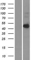 CerS6 / LASS6 Protein (Over-Expression Lysate Myc-DDK (Flag))