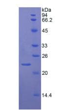 Rat VWF / Von Willebrand Factor Protein (Recombinant His)