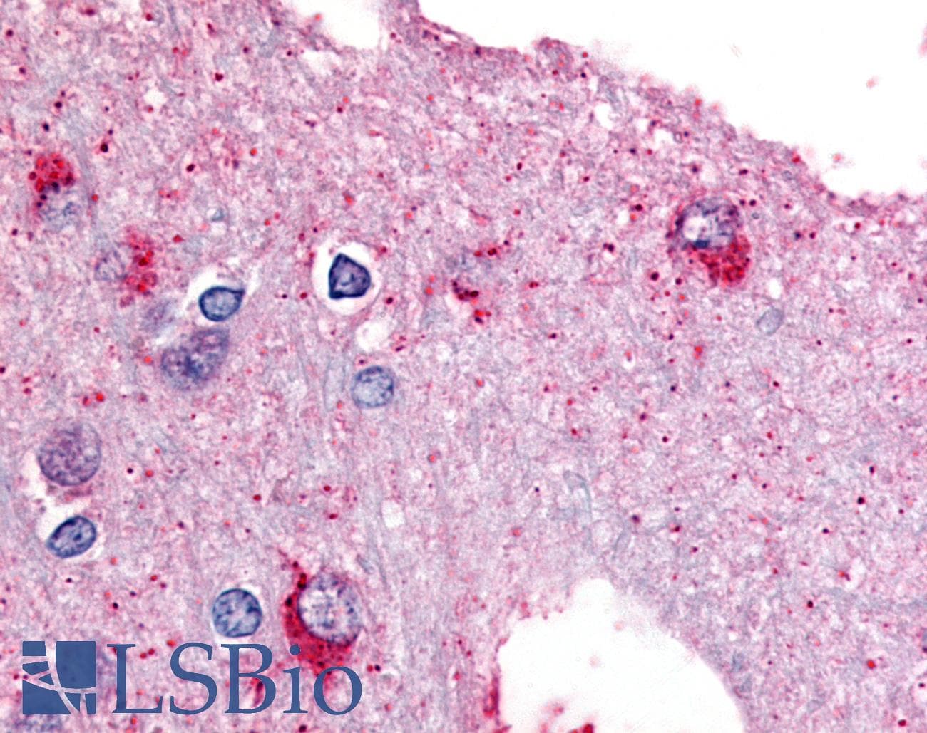 IHC-plus™ PYG Antibody (Internal)