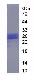 Pig ORM1 / Orosomucoid Protein (Recombinant His-T7)