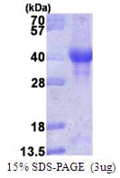 Human PINK1 Protein (Recombinant)