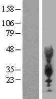 CEACAM21 Protein (Over-Expression Lysate Myc-DDK (Flag))