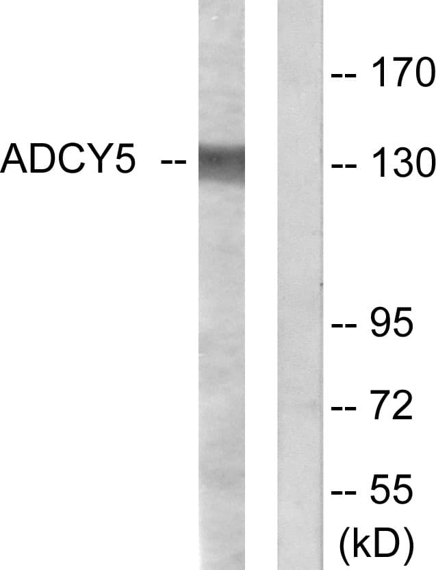 ADCY5+6 Antibody (aa931-980)