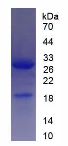 Human SIRT1 / Sirtuin 1 Protein (Recombinant His)