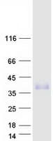 Human TMEM182 Protein (Recombinant Myc-DDK (Flag))
