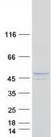 Human REN / Renin 1 Protein (Recombinant Myc-DDK (Flag))