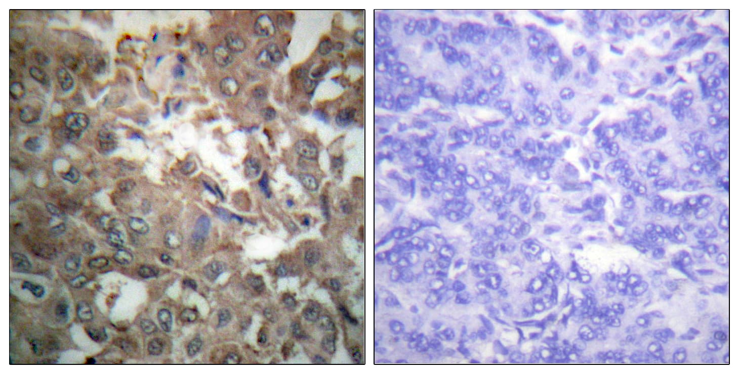 Polyclonal Rabbit anti-Human XPA Antibody (aa211-260, IHC, WB)