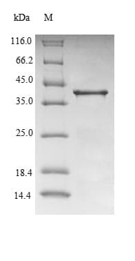 Mouse TTR / Transthyretin Protein (Recombinant GST, N-terminus)