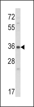 CTGF Antibody (aa315-349)