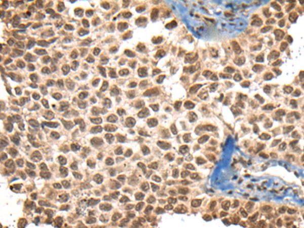 Polyclonal Rabbit anti-Human XPO1 / CRM1 Antibody (IHC, WB)
