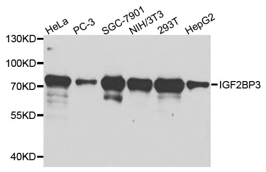 Polyclonal Rabbit anti-Human IMP-3 / IGF2BP3 Antibody (IHC, WB)