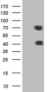 MSLN / Mesothelin Antibody (aa270-493, clone OTI2E5)