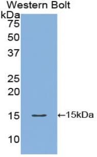 FABP1 / L-FABP Antibody (aa2-126)