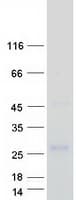 Human GRAP Protein (Recombinant Myc-DDK (Flag))