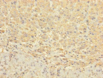 CCDC113 Antibody