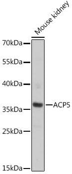 Polyclonal Rabbit anti-Human ACP5 / TRAP Antibody (WB)