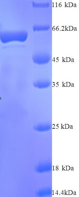 Human IDO2 / INDOL1 Protein (Recombinant His)