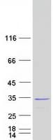 Human SDCBP / Syntenin Protein (Recombinant Myc-DDK (Flag))