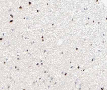 Polyclonal Rabbit anti-Human NR1A2 / THRB Antibody (IHC, IF, WB)