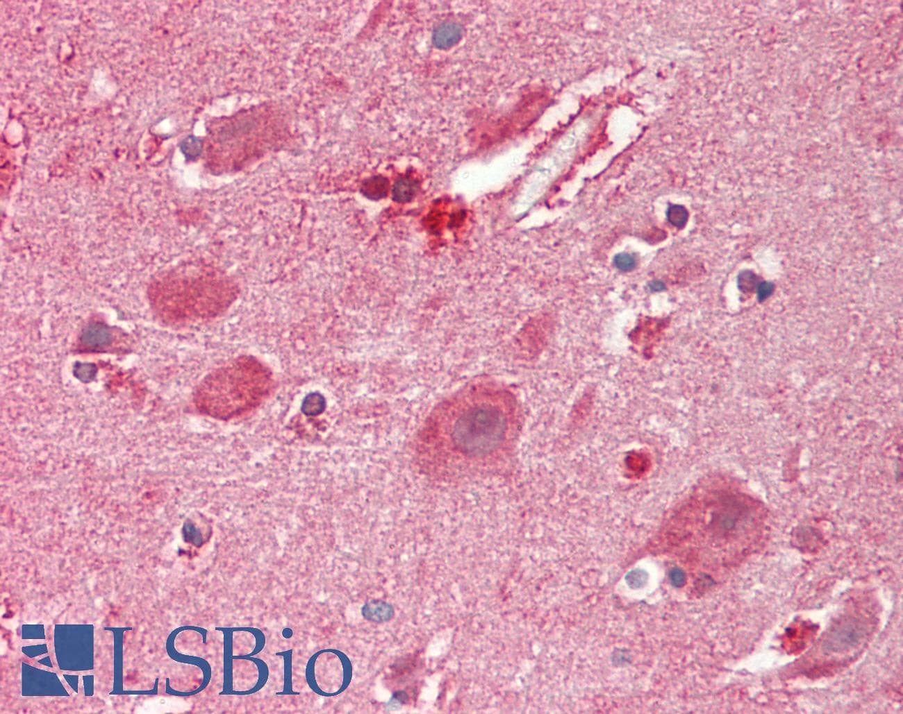 Polyclonal Rabbit anti-Mouse PDX1 Antibody (aa36-85, IHC, WB)