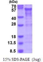 Human CREB3L2 / BBF2H7 Protein (Recombinant His)
