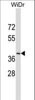 DUOXA2 Antibody (aa286-314)
