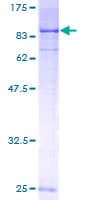 Human SGK3 Protein (Recombinant GST)