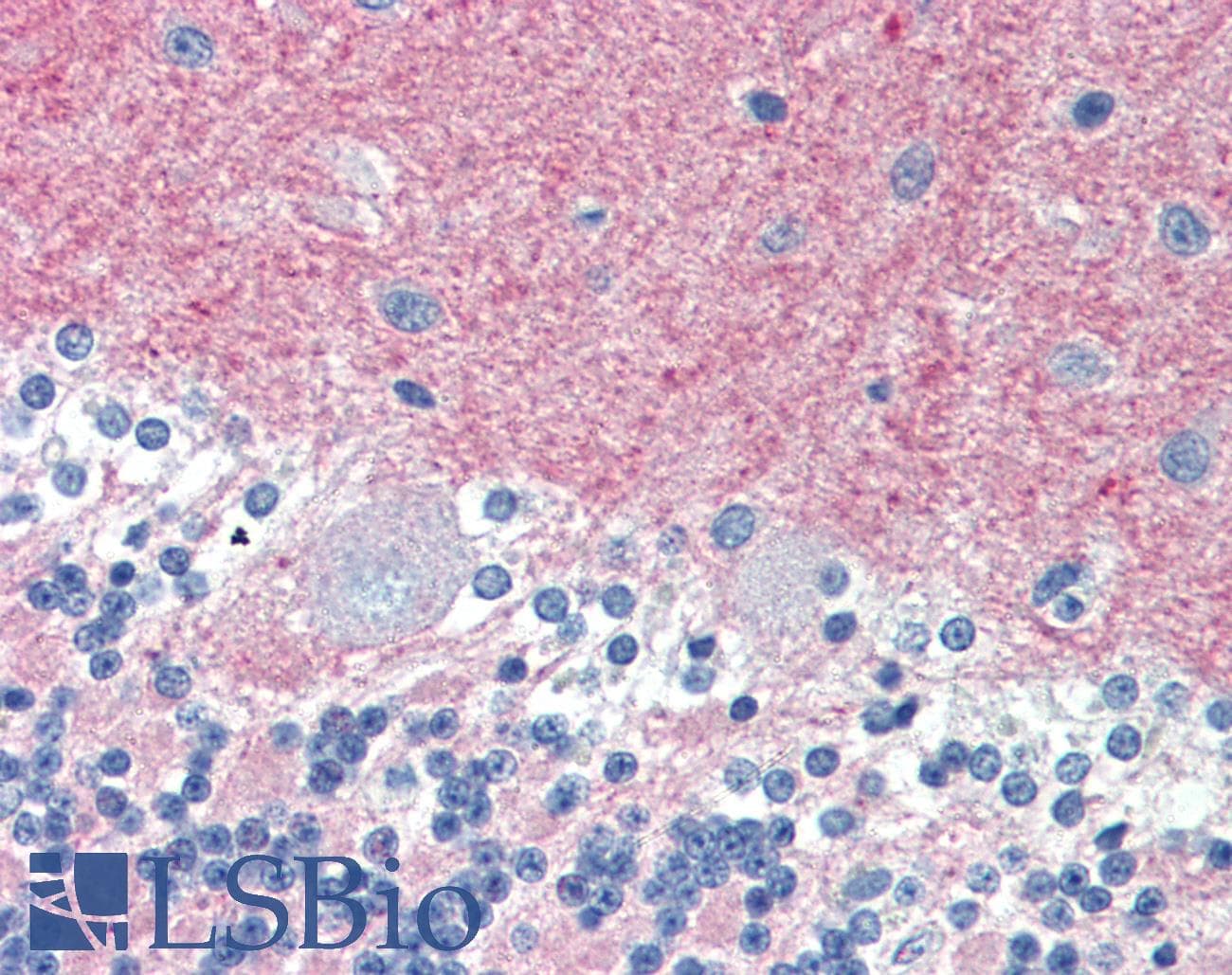 PathPlus™ Monoclonal Mouse anti-Human THY1 / CD90 Antibody (clone 5E10, IHC)