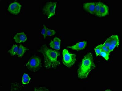 GABRQ / THETA Antibody