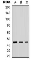 Polyclonal Rabbit anti-Human B4GALT2 Antibody (C-Terminus, IHC, WB)
