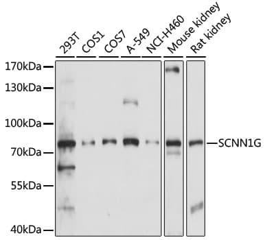 Polyclonal Rabbit anti-Human SCNN1G / ENaC Gamma Antibody (WB)