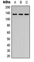Polyclonal Rabbit anti-Human ABL1 / c-ABL Antibody (N-Terminus, IHC, WB)