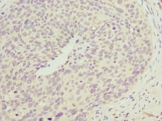 CCM2 / Malcavernin Antibody