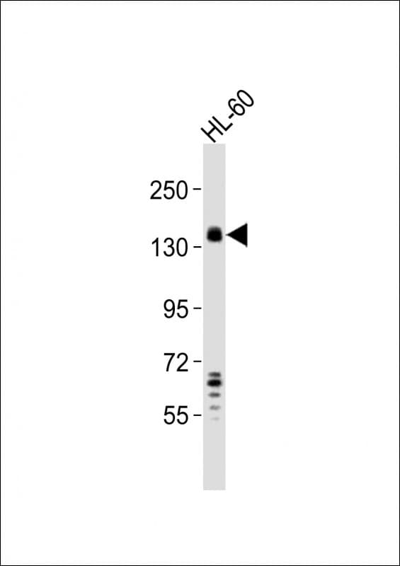 Polyclonal Rabbit anti-Human SEMA4D / Semaphorin 4D / CD100 Antibody (aa553-587, WB)