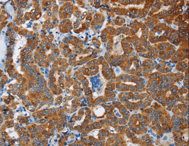 FLCN / Folliculin Antibody