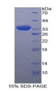 Human PVRL2 / CD112 Protein (Recombinant His-T7)