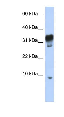 Polyclonal Rabbit anti-Human PXT1 Antibody (C-Terminus, WB)